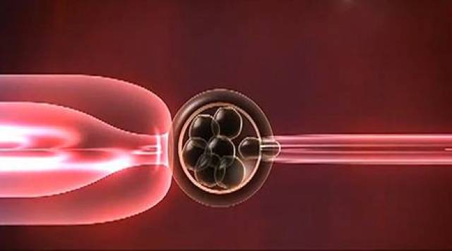 显微操作